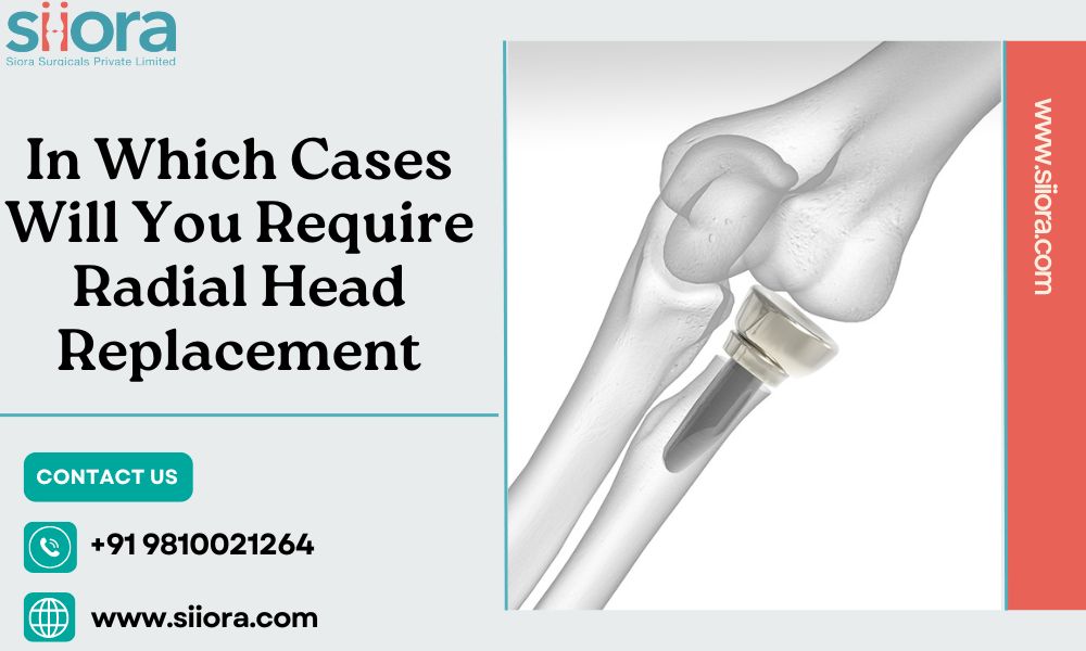 Radial Head Replacement